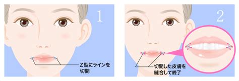 口角 場所|口角(コウカク)とは？ 意味や使い方